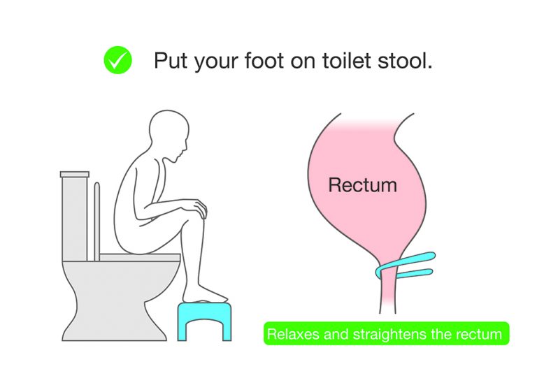 Why Using A Squatty Potty Isn't Such A Crazy Idea